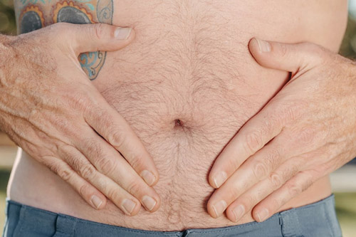 Managing IBS